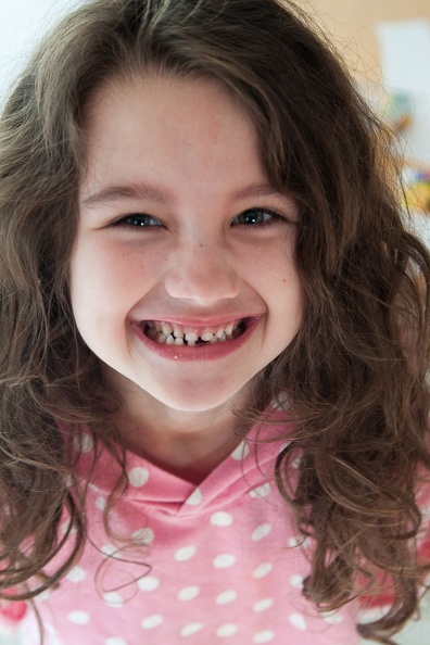 Emi with Missing Tooth!